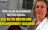 Türk bilim insanı Doç. Dr. Hande Özdinler ölü beyin hücrelerini yeniden canlandırdı