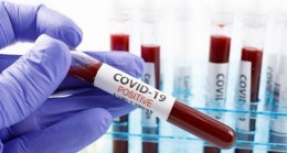 İngiltere’de 741 bin adet korona virüs testinde güvenlik endişesi