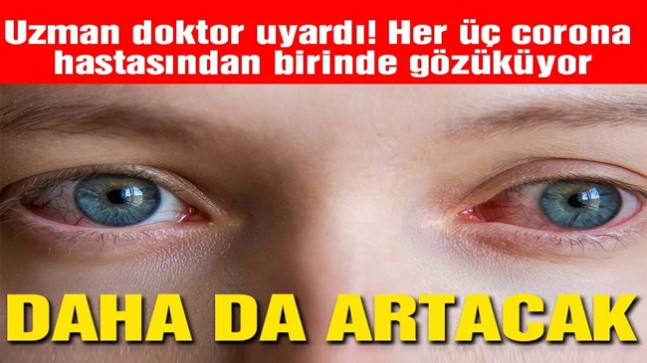Gözlere dikkat: ‘3 coronalıdan birinde görünüyor’